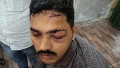 Photo of भैंसोंनी ग्राम प्रधान पर युवक को पिटवाने का लगा आरोप