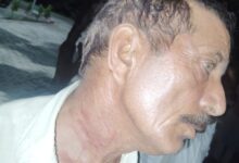 Photo of बीती रात दबंगों ने बाजार में मचाया तांडव दुकानदार को पीटकर नगदी सोने की चैन छीनकर फरार, अब पुलिस हिरासत में